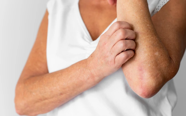mature woman elbow